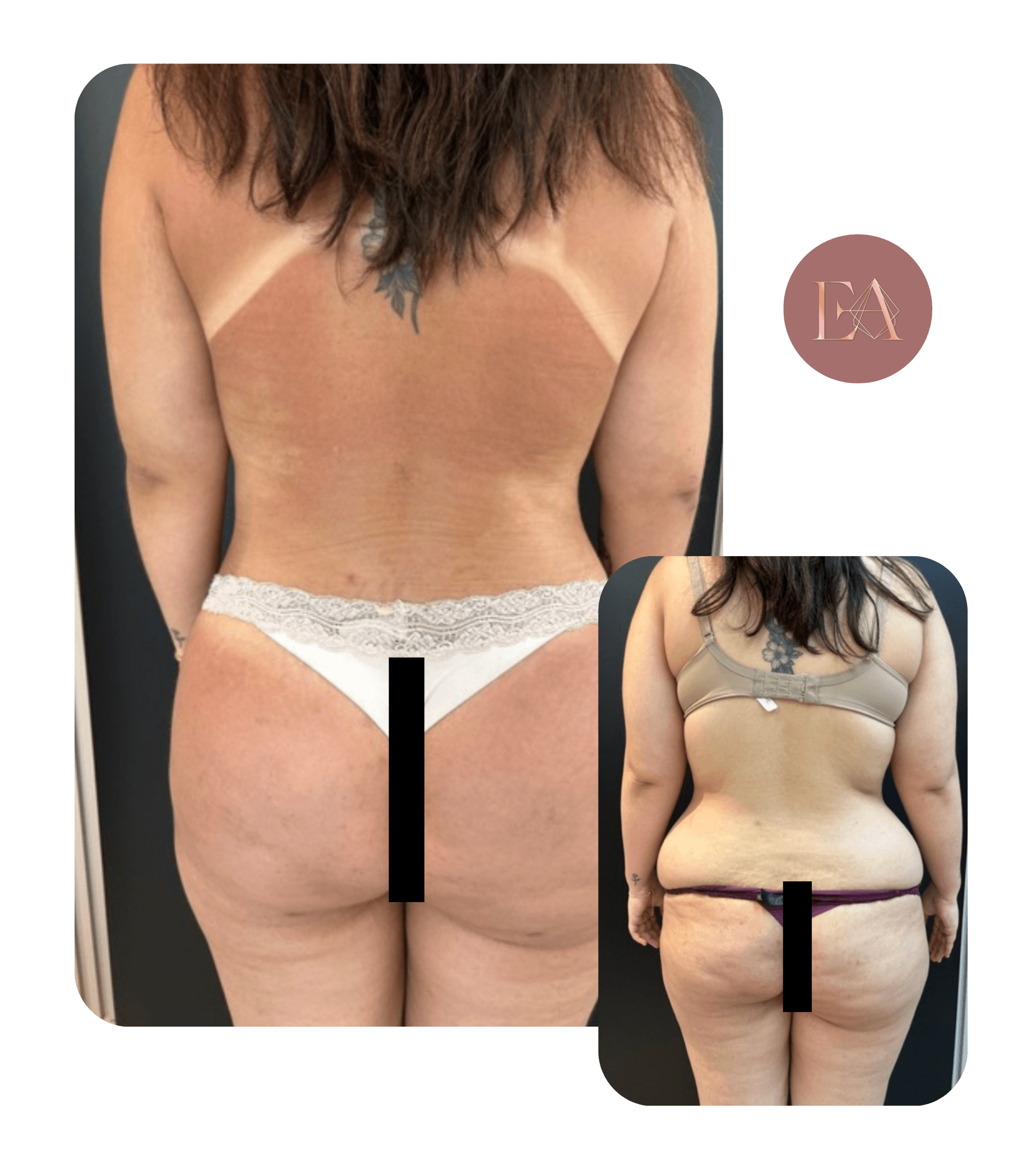 Antes e depois de paciente da Dra. Emelyn